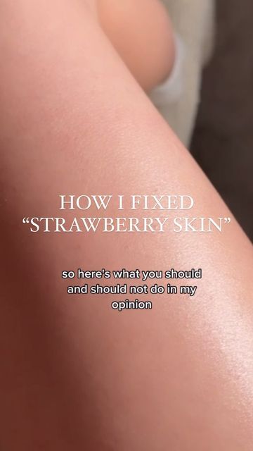 How To Deal With Strawberry Skin, Smooth Arms Skin, Diy How To Get Rid Of Strawberry Legs Fast, How To Prevent Strawberry Skin, Strawberry Arms Remedy, Kerotisis Pilaris, Kp Skin Remedies, How To Fix Strawberry Skin, How To Get Ride Of Strawberry Legs At Home