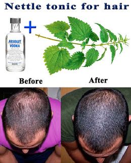 Diy Nettle Shampoo, Hair Growth Oil Diy, Nettle Shampoo, Hair Growth Naturally, Grow Natural Hair Faster, How To Grow Natural Hair, Home Remedies For Hair, New Hair Growth, Tips Hair