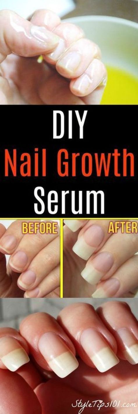 1/2 TL Aloe Vera Gel 1/2 TL Rizinusöl 1 Vitamin E Kapsel eine Knoblauchzehe #nai ... Homemade Nail Growth, Nail Growth Serum, Grow Nails Faster, Weak Nails, Diy Kosmetik, Broken Nails, Brittle Nails, Nail Growth, Growth Serum