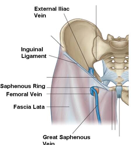 Fascia lata >>Deep fascia of thigh ; named from its great extent Lata is a Latin word means broad sheet >> The fascia lata is attached ✓ posteriorly to the sacrum and coccyx. ✓ laterally to the iliac crest; ✓ in front to the inguinal ligament and to the superior ramus of the pubis ✓ medially, to the inferior ramus of the pubis, to the inferior ramus and tuberosity of the ischium, and to the lower border of the sacrotuberous ligament. ￼ >>The fascia lata invests the entire length of Sacrotuberous Ligament, Inguinal Ligament, Iliac Crest, Fascia Lata, Latin Word, Lower Limb, Latin Words, Medicine