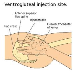 injection sites Im Injection Sites, Cna Training, Nursing Fundamentals, Injection Sites, Im Injection, Nurse Skills, Nurse Notes, Nurse Teaching, Nursing Board