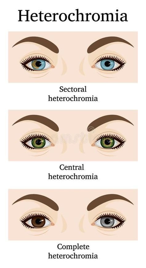 Complete Heterochromia, Heterochromia Iridum, Eye Color Chart, Eye Facts, Beautiful Eyes Color, Writing Inspiration Tips, Types Of Eyes, Book Writing Inspiration, Aesthetic Eyes