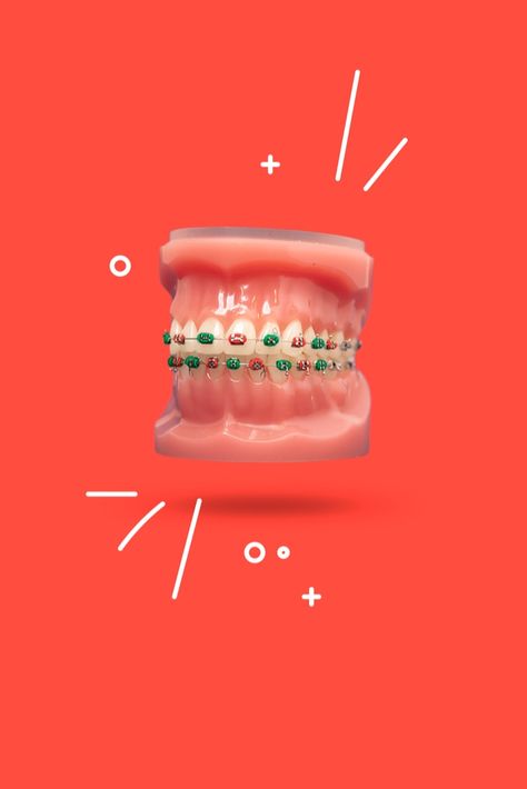 ‘Tis the season for holiday color tie combos for your braces! 🎄Ask for aqua + white (Frosty the Snowman), fire red + hunter green (The Grinch) or fire red + white (Rudolph) at your next appointment! White Braces, Green Braces, Ceramic Braces, Red Hunter, Mission Work, Metal Braces, Frosty The Snowman, Frosty The Snowmen, The Snowman