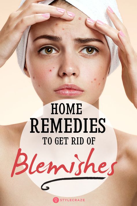 Get Rid Of Blemishes On Face, How To Get Rid Of Blemishes On Face, Blemishes On Face Remedies, Blemishes On Face, Face Recipes, Blemish Remedies, Dry Skincare, Face Health, Acne Mask