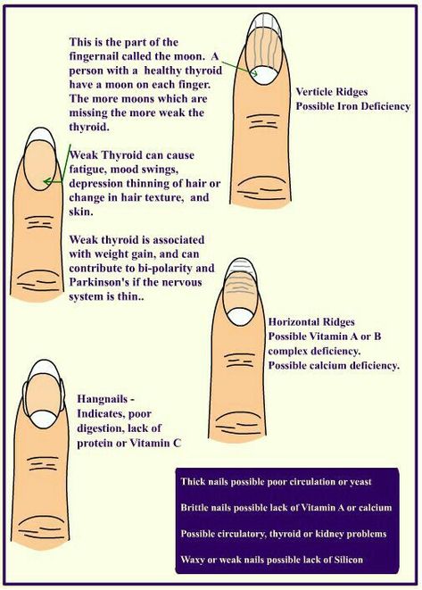 Fingernail Health, Sport Nutrition, Health Signs, Thyroid Health, Nail Health, Natural Health Remedies, Health Info, Health Facts, Natural Medicine