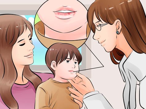 How to Fix a Toddler's Chapped Lips: 12 Steps (with Pictures) Chapped Lips Remedy, Reduce Hair Growth, Upper Lip Hair, Dry Cracked Lips, Pimples Remedies, Cracked Lips, Petroleum Jelly, Lip Hair, 12 Steps