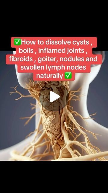 Essential Oils For Baker Cysts, Castor Oil For Lymph Drainage, How To Get Rid Of Cysts On Ovaries, Castor Oil For Cysts, Castor Oil For Thyroid, Castor Oil For Hemmoroids, How To Treat Boils, Yoga Bedtime, Medicinal Recipes