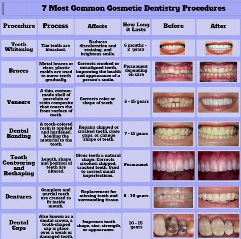 Dental Assistant Study, Cosmetic Dentistry Procedures, Dental Offices, Kedokteran Gigi, Dental Implants Cost, Dental Hygiene School, Dental Facts, Emergency Dentist, Dental Bridge