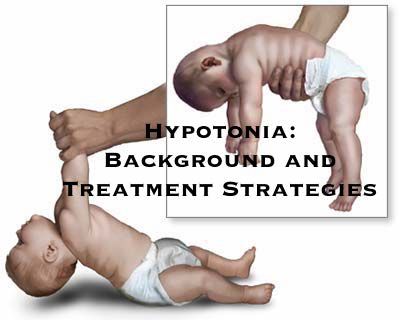 Dinosaur Physical Therapy - Hyptonia: Exercises to Help Your Baby with Low Muscle Tone | ilslearningcorner.com Brain Development Children, Global Developmental Delay, Low Muscle Tone, Pediatric Physical Therapy, Integrated Learning, Pediatric Occupational Therapy, Physical Therapy Exercises, Preschool Activities Toddler, Pediatric Therapy