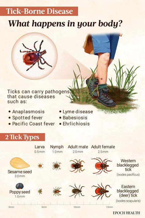 Tick-Borne Diseases: Symptoms, Causes, Treatments, and Natural Approaches | The Epoch Times Deer Ticks, Tick Bite, Disease Symptoms, Red Blood Cells, Blood Cells, Medicinal Herbs, Ticks, Apothecary, Disease