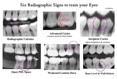 Dental Assistant Study Guide, Registered Dental Assistant, Dental Assistant School, Dental Hygienist School, Dental Assistant Study, Dental Hygiene Student, Dental World, Kedokteran Gigi, Dental Hygiene School