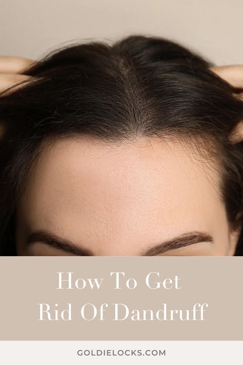 How To Get Rid Of Dandruff Braided Mohawk, Rid Of Dandruff, Apple Dumpling, Goldie Locks, Getting Rid Of Dandruff, Scalp Treatments, 2023 Hair, Hair Growing Tips, Mohawk Braid