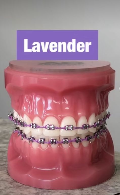 Lavender Braces, Dental Braces Colors, Braces Colors Combinations, Pink Braces, Diy Braces, Braces Bands, Cute Braces Colors, Braces Tips, Getting Braces