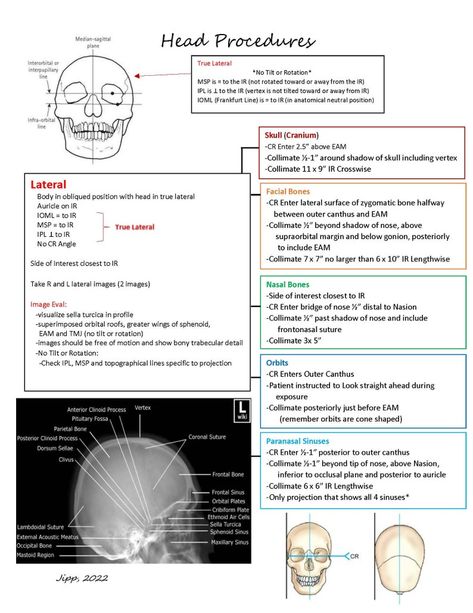 X Ray Tech Student, Radiography Student, Charting For Nurses, Medical Radiography, Learning Psychology, Medical Assistant Student, Radiology Student, Basic Anatomy, Radiology Technician