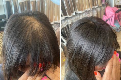 Hairstyles To Hide Thinning Crown, Wedding Hair Thinning Hair, Style Thinning Hair Women, Hair Colour For Thinning Hair, Hair Styles For Receding Hairline Women, Balding Hairstyles Women, Hairstyles For Front Thinning Hair, Hairstyle Thinning Hair Women, How To Hide Thinning Front Hair