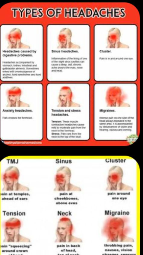 Types Of Headaches Chart, Headache Location Meaning, Headache Location, Headache Chart, Different Types Of Headaches, Remedy For Sinus Congestion, Home Remedies For Sinus, Sinus Congestion Relief, Headache Causes