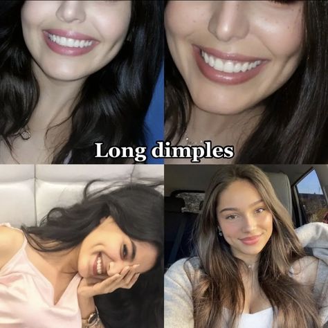 Jaw Reduction Surgery, V Line Surgery, Face Surgery, Plastic Surgery Gone Wrong, Cheek Fillers, Celebrity Plastic Surgery, Celebrities Before And After, Eye Surgery, Nose Job