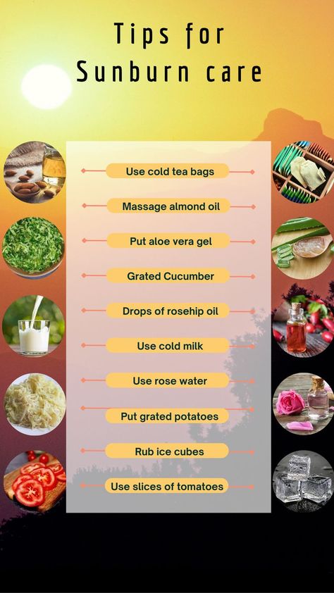 Home Remedies For Sunburn, How To Treat Sunburn, Aloe Vera For Sunburn, Burn Care, Natural Remedies For Sunburn, Sunburn Skin, Sunburn Remedies, Natural Remedies For Migraines, Sunburn Relief