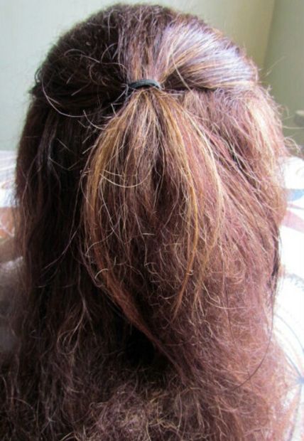 Picture of fizzy hair? Natural Hair Removal Remedies, Fizzy Hair, Back Acne Remedies, Remove Skin Tags Naturally, Acne Makeup, Underarm Hair Removal, Skin Tags, Get Rid Of Blackheads, Unwanted Hair Removal