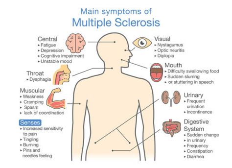 Ms Symptoms, Nerve Fiber, Stiff Neck, Yellow Fever, Muscle Weakness, Nerve Damage, Neurological Disorders, Central Nervous System, Nerve Pain