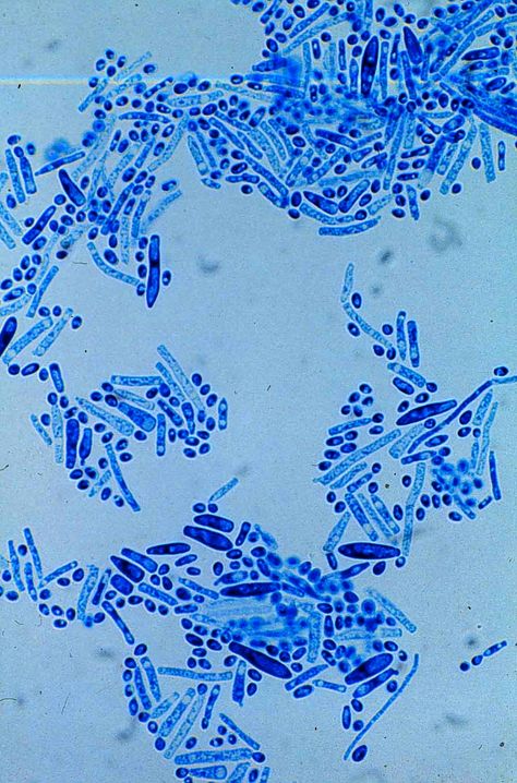 trichosporon / fungi print inspiration Bacteria Under Microscope, Bacteria Culture, Microbiology Lab, Microscopic Photography, Biology Labs, Microscopic Images, Notebook Cover Design, Bio Art, Weird Science