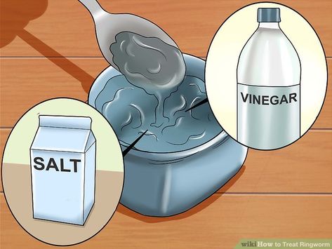 How to Treat Ringworm (with Pictures) - wikiHow Toe Nail Fungal Infection, Fingernail Fungus, Toenail Fungus Remedies, Fiberglass Shower, Bronze Fixtures, How To Clean Rust, Bronze Bathroom, Fungal Nail, Bathtub Drain