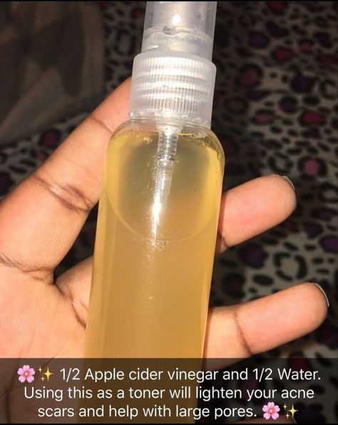 Apple Cider Vinegar Toner, Apple Cider Vinegar For Skin, Lighten Scars, Apple Vinegar, Skin Care Routine 30s, Vinegar Uses, Skincare Quotes, Skin Care Routine Steps, Toner For Face