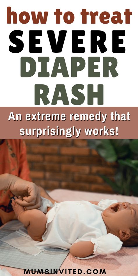 Nappy Rash Remedies Natural, Natural Diaper Rash Cream, Diaper Rash Remedy Severe, Natural Diaper Rash Remedies, Diaper Rash Cream Recipe, Home Remedies For Rashes, Diaper Rash Remedy, Rashes Remedies, Home Remedies For Skin