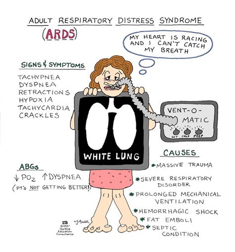 Acute Respiratory Distress Syndrome (a.k.a.: Noncardiogenic Pulmonary Edema, Adult Respiratory Distress Syndrome, Shock Lung) Acute Respiratory Distress, Nursing Respiratory, Respiratory Distress, Nursing Information, Nursing Mnemonics, Medical Surgical Nursing, Surgical Nursing, Respiratory Care, Critical Care Nursing