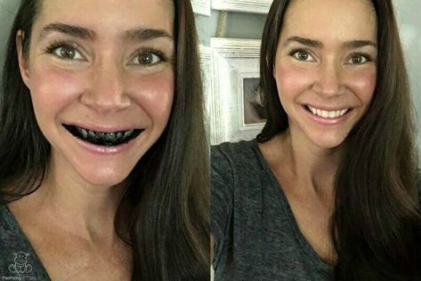 adsorption Hismile Teeth Whitening, Natural Teeth Whitening Remedies, Activated Charcoal Teeth Whitening, Teeth Whitening Homemade, Get Whiter Teeth, Teeth Whitening Remedies, Teeth Whitening Diy, Teeth Whitening Toothpaste, Charcoal Teeth Whitening