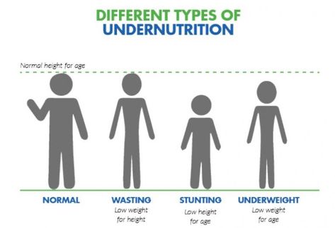 Malnutrition, its Causes and Types of Malnutrition - Public Health Notes Health Notes, Weight For Height, Food Insecurity, Term Paper, Make It Easy, Public Health, Health And Nutrition, Weight Gain, Science Poster