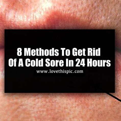 8 Methods To Get Rid Of A Cold Sore In 24 Hours How To Get Rid Of Cold Sores, Cold Sore Remedy Quick Overnight, Cold Sore Remedy Overnight, Stages Of A Cold, Cold Sore Remedy, Cold Sore Stages, Swelling Remedies, Natural Cold Sore Remedy, Cleaning With Peroxide