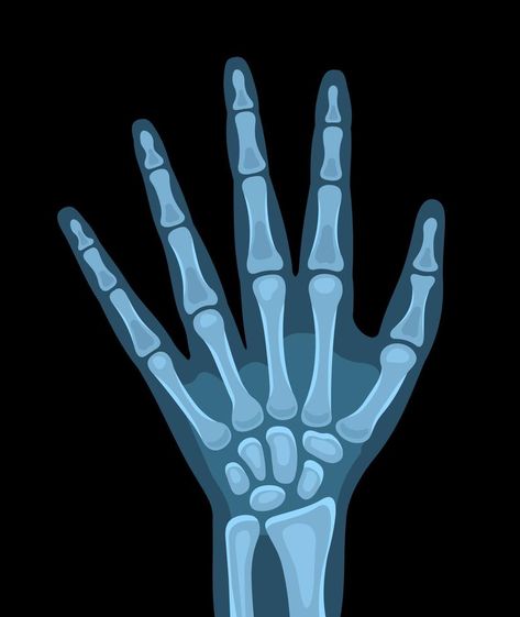 Vector illustration of x-ray picture of the human body, hand. Vector illustration X Ray Drawing Easy, X Ray Illustration, X Ray Pictures, Xray Drawing, Xray Pictures, X Ray Drawing, Hand Xray, X Ray Hand, Xray Art