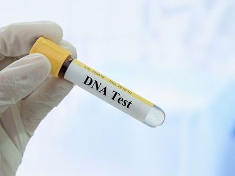 Dna Test Results, High Court Judge, Cholesterol Test, Dog Dna Test, Paternity Test, Ancestry Dna, Fun Test, Genetic Testing, High Schools