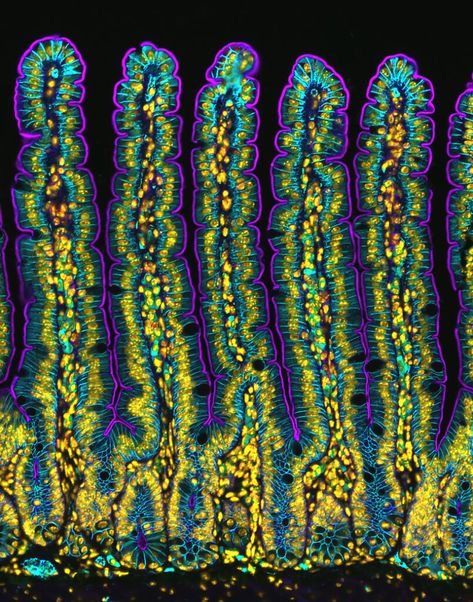 Nikon Small World, Augusta University, Sunset Moth, Best Nature Images, Microscopic Images, Slime Mould, Regenerative Medicine, Photography Competitions, Medical University