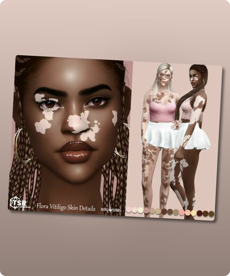 Sims 4 Flora Vitiligo Skin Details These Vitiligo Skin Details comes in full body in 2 different versions with 15 skin colors for each version. It is suitable for all genders and ages. You can find it in the Skin Detail category. Base Game and HQ Mod Compatible. Filesize: 8 MB Recoloring Allowed: No Author:Continue reading "Flora Vitiligo Skin Details By Msqsims" #gaming #hq_mod #skins #sims4 #sims4cc #base_game Sims 4 Cc Download, The Sims 4 Packs, Skin Details, Sims 4 Cc Skin, Nose Mask, Skin Patches, Model Nails, Skin Colors, Best Sims