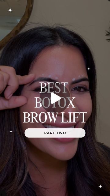 Brow Lift Makeup, Brow Lift Botox Eyebrows, Brow Lift Before And After, Botox Brow Lift Before And After, Botox Eyebrow Lift, Brow Lift Surgery, Botox Brow Lift, Eyebrow Before And After, Botox Before And After