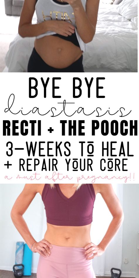 EVERY MAMA DO THIS!!! Heal diastasis recti with this ab rehab program created by a mom of 3 and Pilates instructor! Super simple to do, and videos! #diastasisrecti #mommypooch #postpartum #losethepooch #newmommy Diastasis Recti Program, An Rehab Exercises, Postpartum Diastasis Recti Exercises, Post Partum Pilates, Ab Rehab Post Pregnancy, Ab Rehab Exercises, Postpartum Ab Rehab, Pilates For Diastasis Recti, Postpartum Workout Diastasis Recti