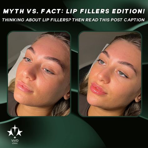 💋 Thinking about lip fillers? Let’s set the record straight with some Myths vs. Facts! 💉✨ 🚫 Myth: Lip fillers will make my lips look unnatural. ✅ Fact: At Vivid Clinic, our skilled experts provide tailored results that enhance your natural beauty. 🚫 Myth: Lip fillers are permanent. ✅ Fact: Lip fillers typically last 6-12 months and can be adjusted to your preference. 🚫 Myth: Lip fillers are painful. ✅ Fact: Our procedures include numbing agents, so discomfort is minimal. 💬 Ready to enhanc... Myths Vs Facts, Beauty Myth, Lip Fillers, 12 Months, Natural Beauty, Lips, Let It Be, Reading, Beauty