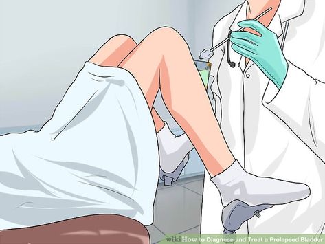 How to Diagnose and Treat a Prolapsed Bladder (with Pictures) Prolapsed Bladder, Gallbladder Symptoms, Prolapse Exercises, Bladder Exercises, Bladder Prolapse, Pelvic Organ Prolapse, Bladder Leakage, Bladder Control, Pelvic Floor Exercises