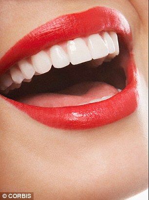 Dental Bridge Cost, Pretty Teeth, Dental Implants Cost, Beautiful Teeth, Teeth Whitening System, Perfect Teeth, Dental Bridge, Smile Teeth, Best Teeth Whitening