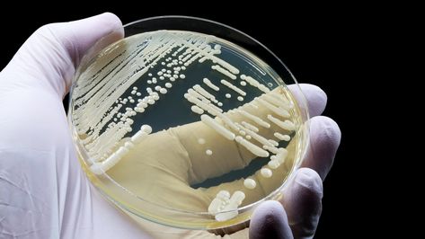 New fungal infection discovered in China | Live Science Types Of Fungi, Bacterial Infection, Fungal Infection, Alzheimers