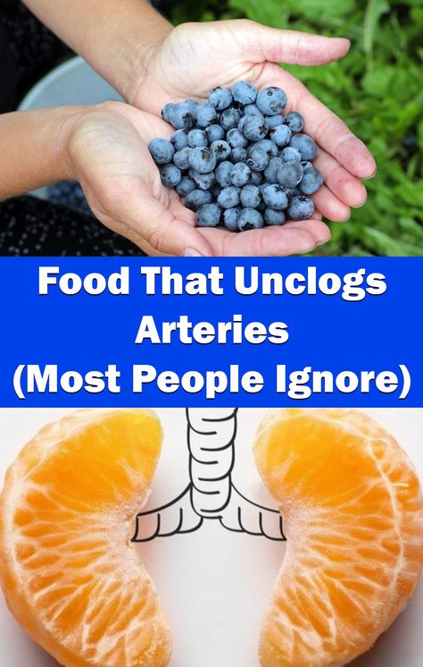 Artery Cleanse, Foods For Heart Health, Clean Arteries, Unclog Arteries, Summer Health, Healthy Superfoods, Clogged Arteries, Heart Healthy Diet, Health And Fitness Magazine