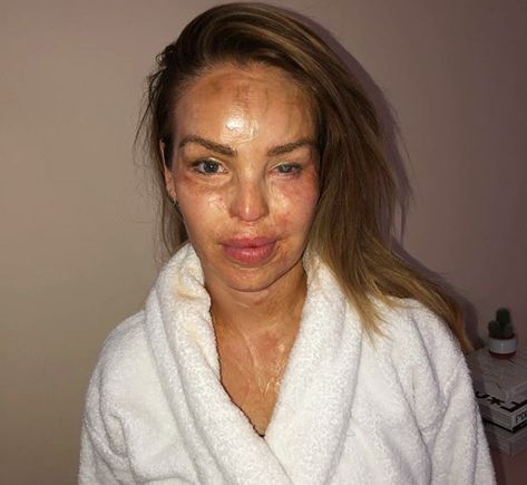 Katie Piper, Facial Surgery, Surgeon Doctor, Fearne Cotton, Left Eye, Free Photographs, Eye Surgery, Bare Face, Free Makeup