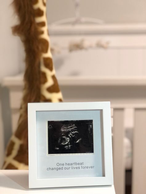 Ultrasound Picture Frame, Pregnancy Announcement Sonogram, Baby Reveal Gift, Gift for Mom, New Mom, One Heartbeat Changed Our Lives Forever https://etsy.me/3aSXG8Y #babygift #pregenantgift #wall #ultrasoundframe #sonogramframe #babysfirstchristmas Sonogram Picture Frame, Ultrasound Picture Frame, Ultrasound Frame, Sonogram Pictures, Baby Announcement Pictures, Ultrasound Pictures, Baby Heartbeat, Pregnancy Announcement Cards, Christmas Pregnancy