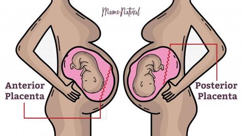 further research shows an anterior placenta appears to be more prevalent in women with O-positive blood; another found that your sleep position during conception may have something to do with it. Anterior Placenta Movement, Placenta Print, Placenta Abruption, O Positive Blood, Anterior Placenta Gender Prediction, Previa Placenta Pregnancy, Anterior Placenta, Placenta Accreta, Bicornuate Uterus Pregnancy