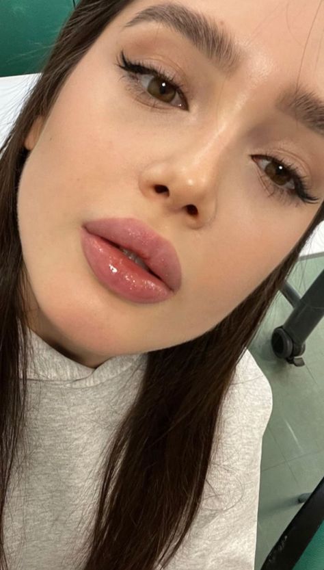 Plumper Lips, Lips Inspiration, Botox Lips, Pretty Nose, Facial Aesthetics, Clear Glowing Skin, Lip Enhancement, Lips Makeup, Lip Shapes