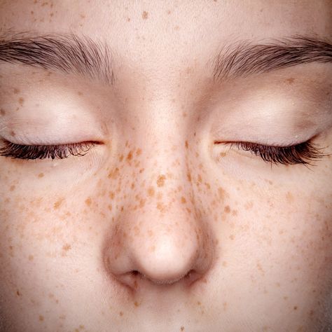 Tattooed Freckles, Beautiful Freckles, Retro Tattoos, Brown Spots Removal, Tattoo Trends, Beauty Trends, Character Inspiration, Portrait Tattoo, Close Up