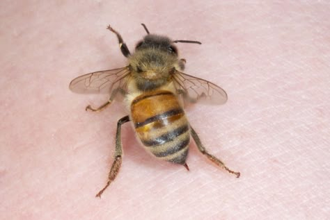 Why You Should Never Remove a Bee Stinger With Tweezers Treating Bee Stings, Remedies For Bee Stings, Wasp Stings, Bees And Wasps, Bee Sting, Save The Bees, Stinger, Wasp, Bee Keeping