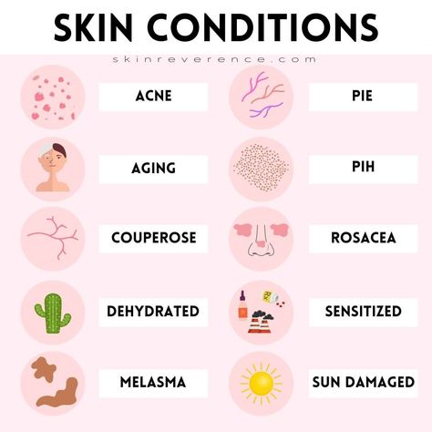 𝙽𝚊𝚝𝚊𝚕𝚒𝚎 | 𝙱.𝚂., 𝚒𝚗 𝙱𝚒𝚘𝚕𝚘𝚐𝚢 on Instagram: “Here are common #SkinConditions that any skin type may experience in any combination! Don’t forget to save this chart for quick reference…” Skin Biology, Skin Types Chart, Healthy Alternatives, Skin Conditions, Skin Type, Biology, Skin Types, Body Care, Instagram Profile